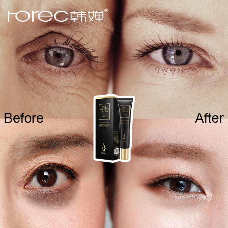 Rorec Krim Mata Anti Aging Eye Cream