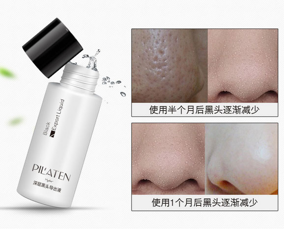 Pilaten Serum Wajah Acne Blackhead Export Liquid 30ml 